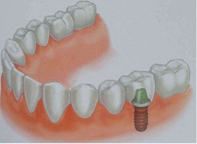检测牙齿年龄，哪些症状提醒牙齿在衰老