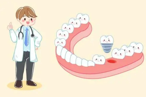种植牙和镶牙的优缺点是什么？