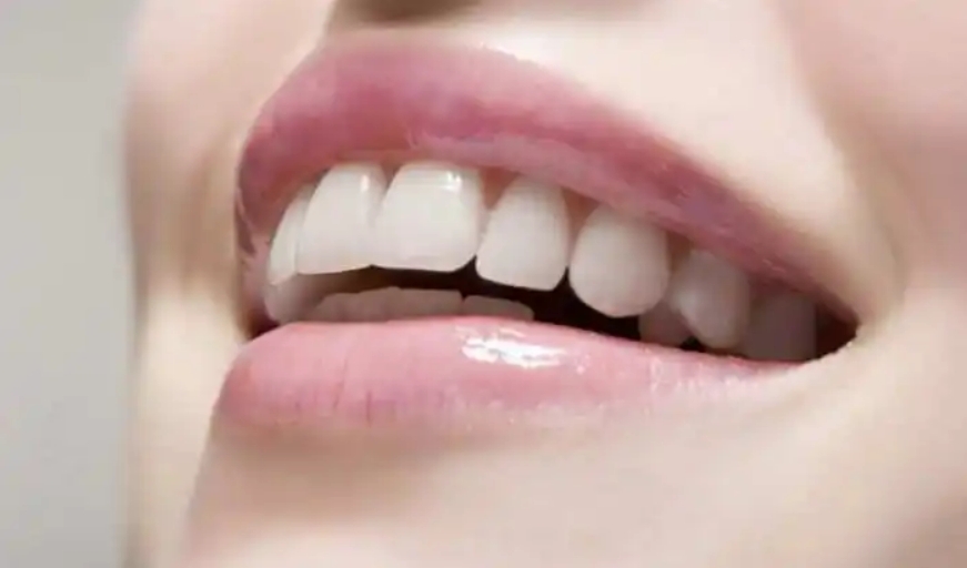牙齿瓷贴面适合哪些人使用？