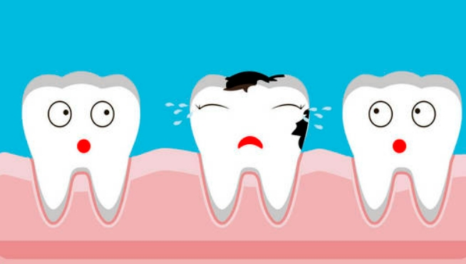 牙齿蛀牙了怎么办？