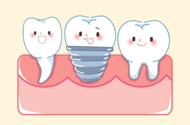 牙齿美学微创种植牙会疼吗?