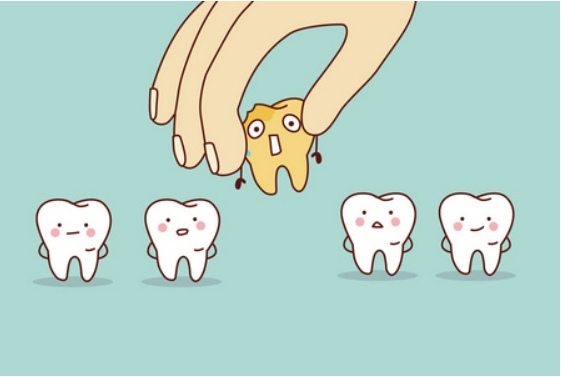 治疗蛀牙有什么办法？需要拔牙吗？