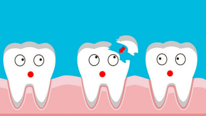 哪种修复牙齿的方法比较好呢？