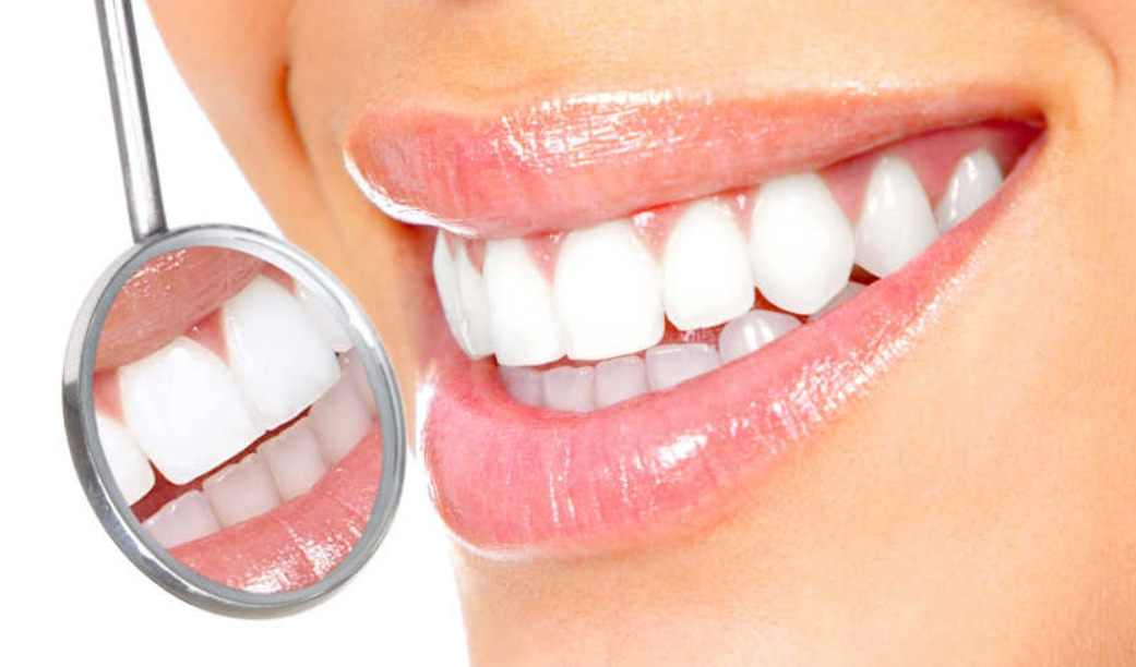 洗牙的频率是多久一次，需要注意哪些事项？