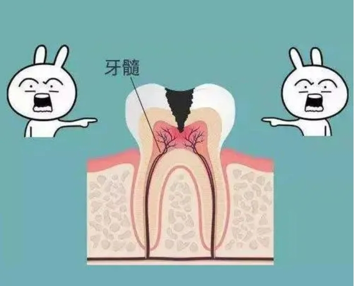 根管治疗为什么不能一次完成呢？