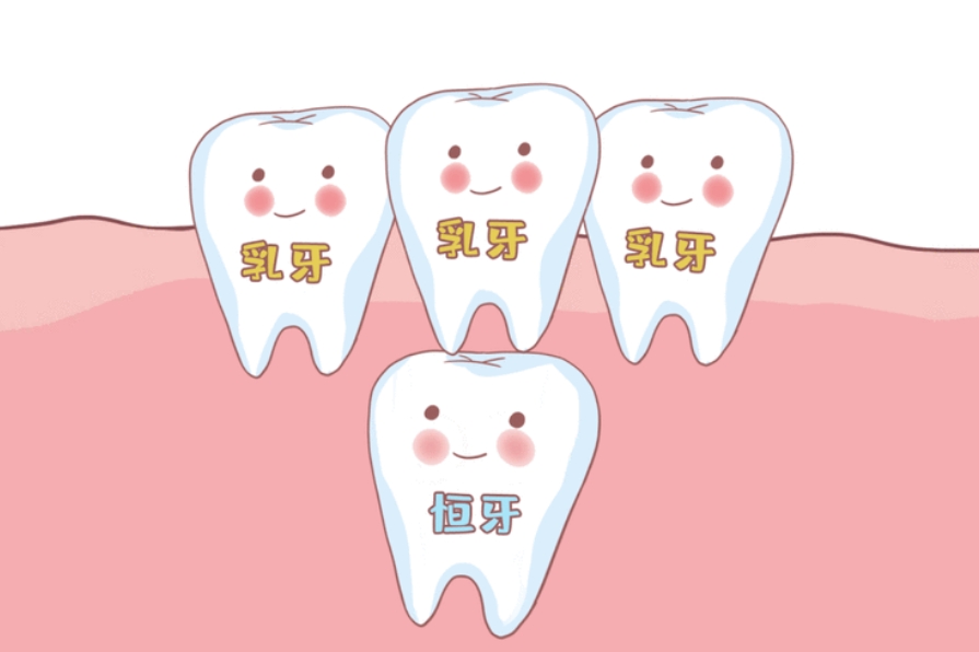 牙齿矫正后为什么会出现黑三角?