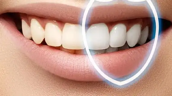 单颗还是连冠?种植牙这样选不踩坑!