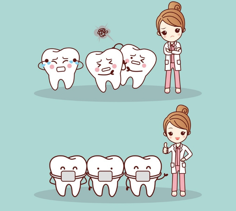 种植牙与天然牙,谁能承受更多咀嚼力?