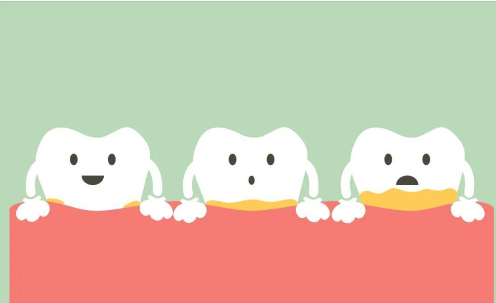 牙髓炎治疗后需要做牙冠吗?