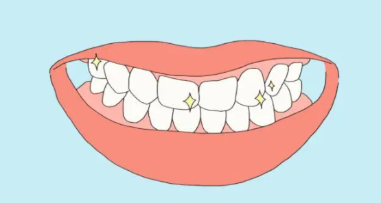 牙周病会遗传吗?日常有哪些注意事项?