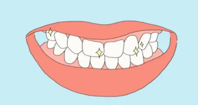 缺牙后,为什么及时修复至关重要?