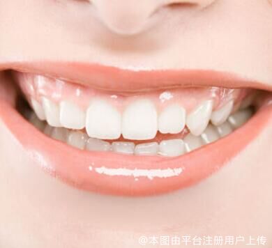 种好的牙齿到底能不能洗牙?