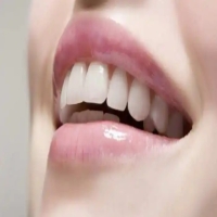 牙齿整形：拥有完美笑容的秘诀